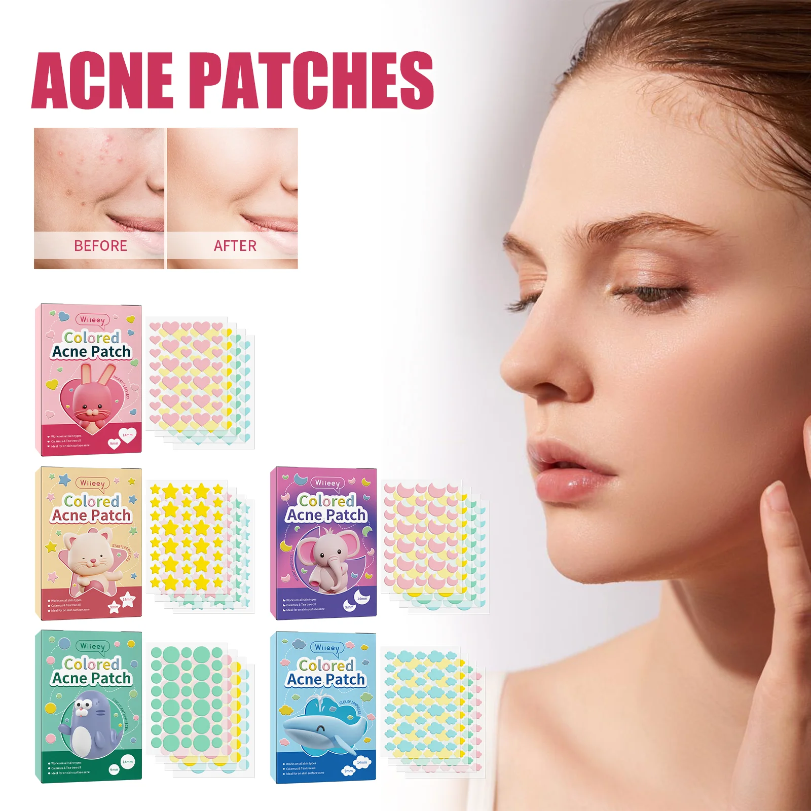 wiieey acne patch series WI HX 017 238