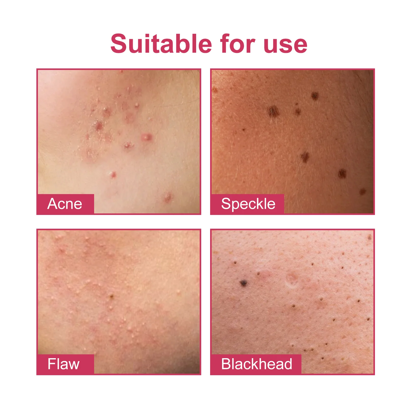 wiieey acne patch series WI HX 017 242