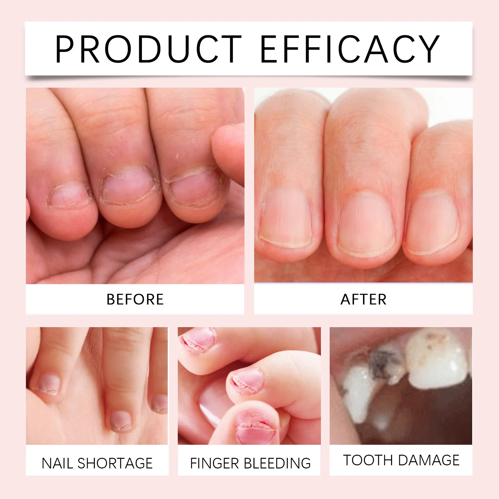 wiieey children protection bitter nail lotion WI HX 041 589