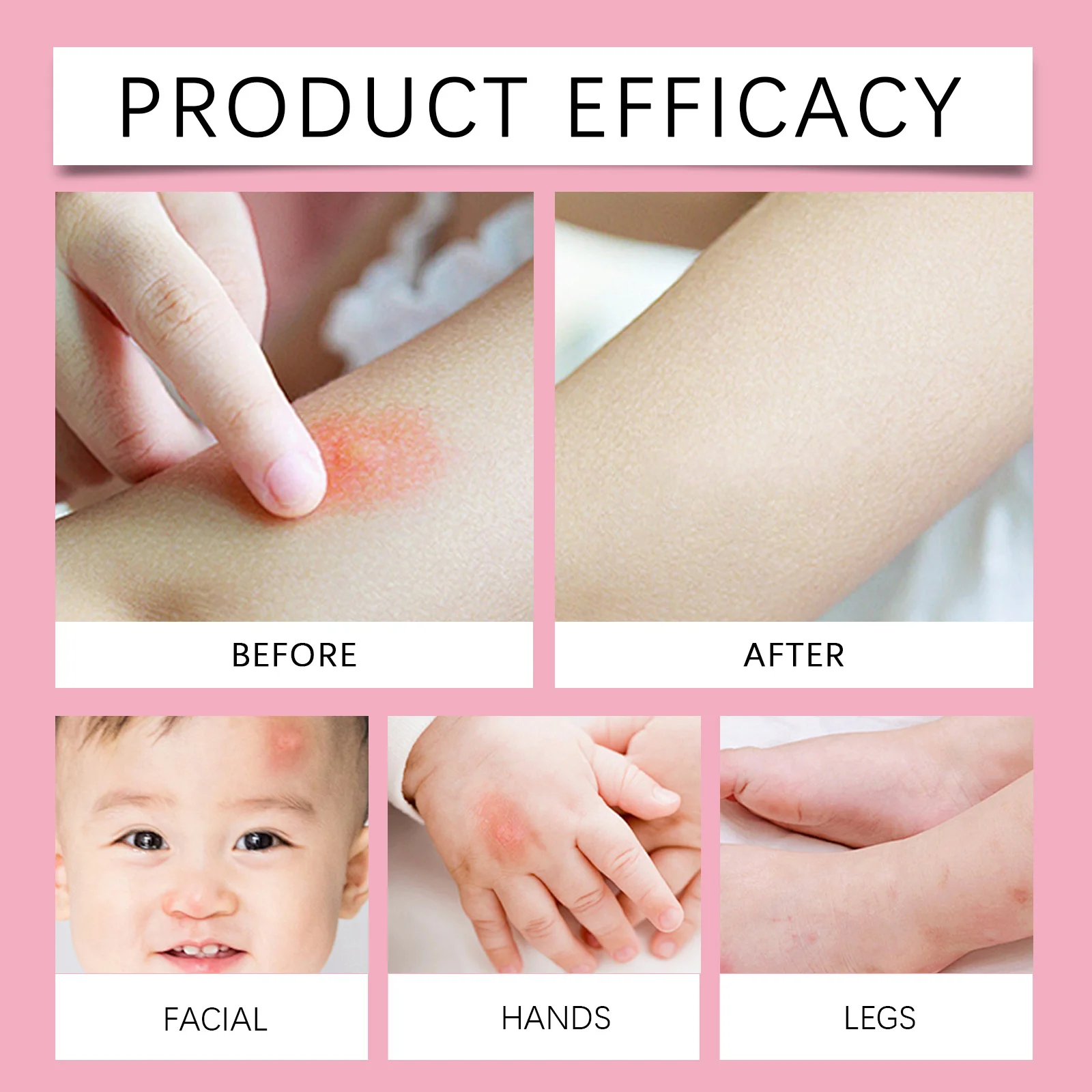 wiieey pregnant babies anti itch mosquito repellent orange WI HX 015 215