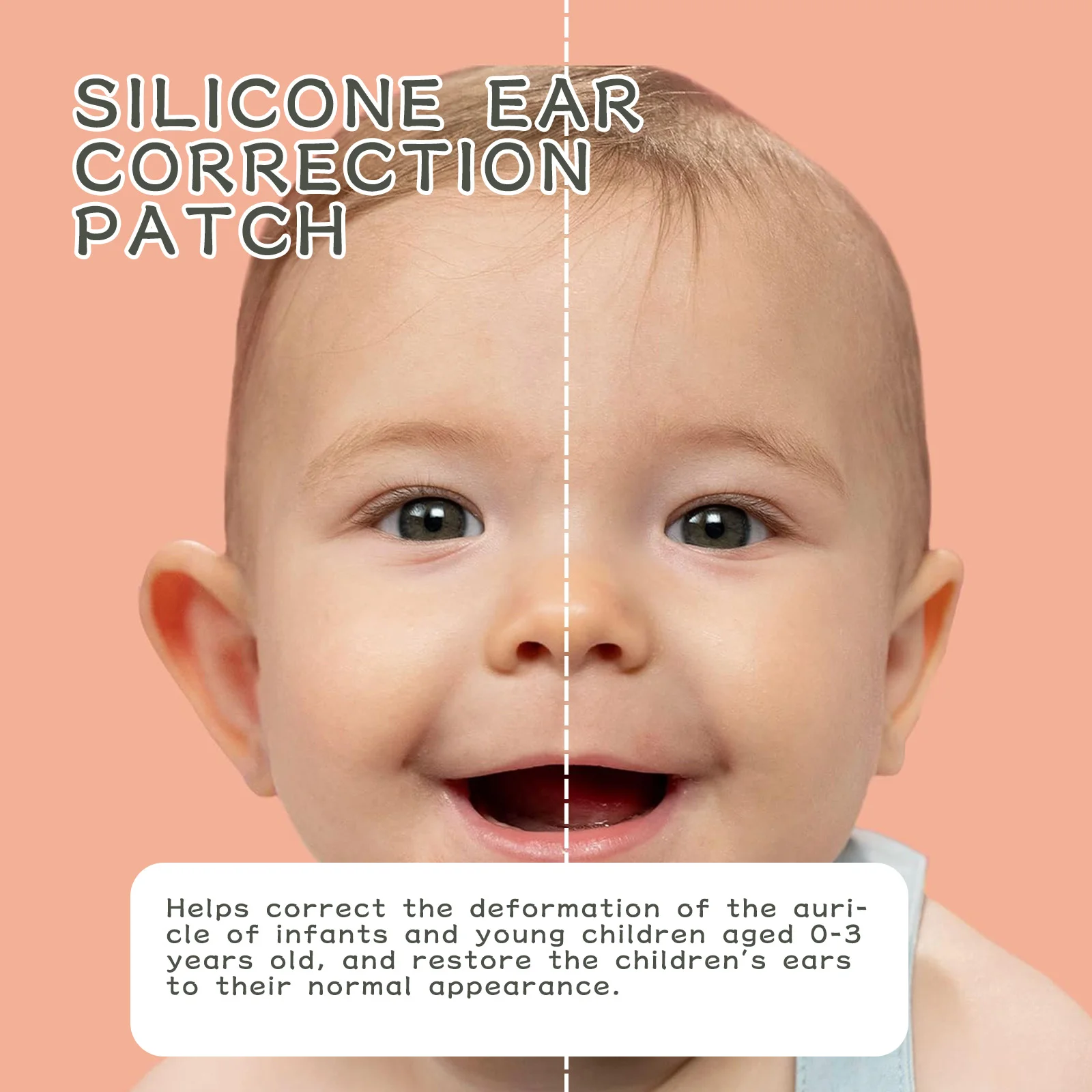 wiieey silicone ear correction patch WI HX 022 316