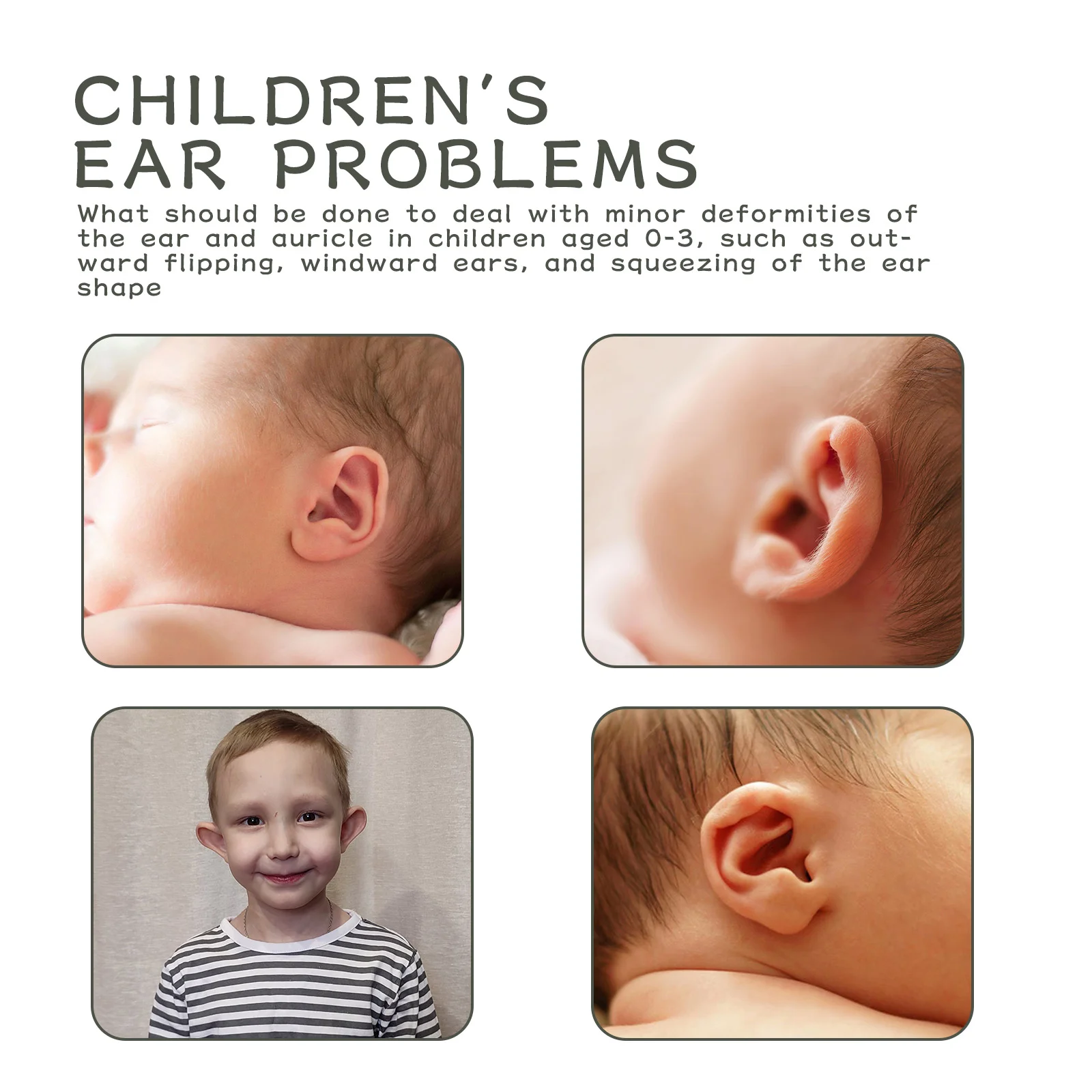 wiieey silicone ear correction patch WI HX 022 317