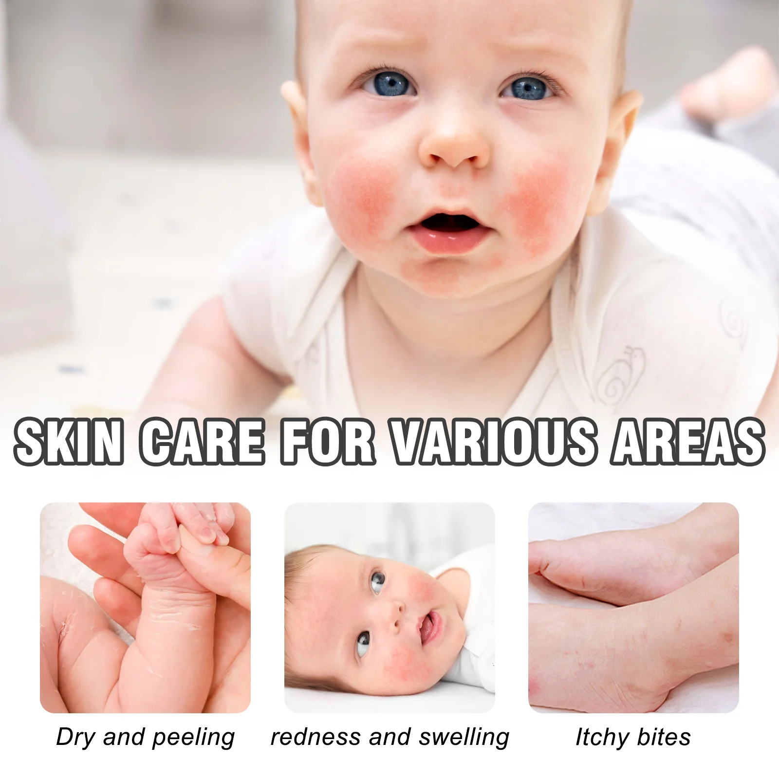 wiieey skin protectant ointment WI HX 031 442