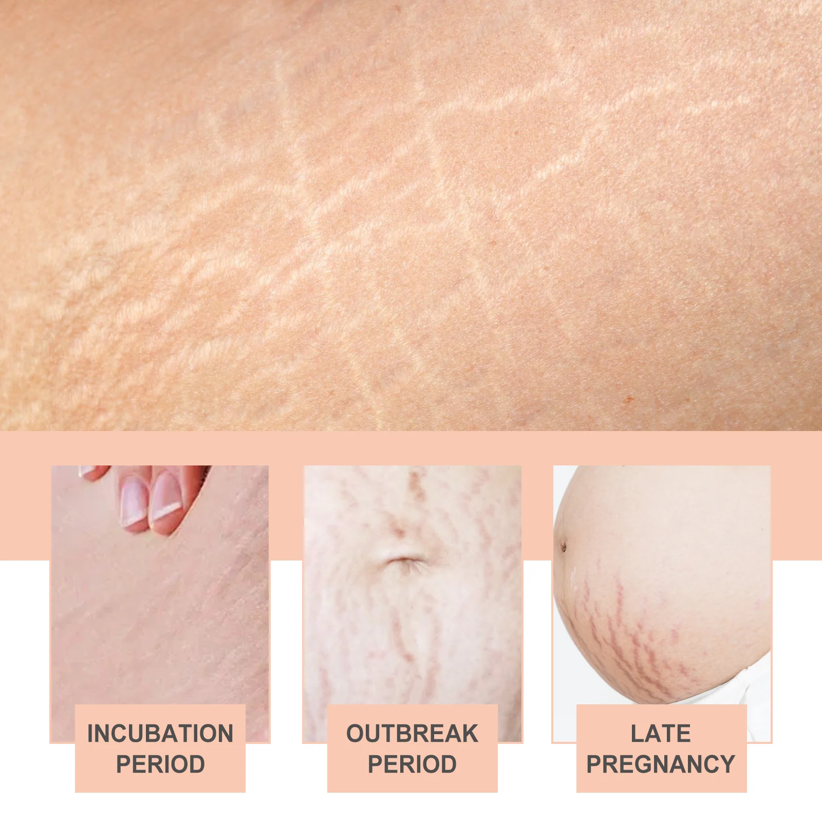 wiieey snail essence pregnancy stretch mark cream WI HX 003 40