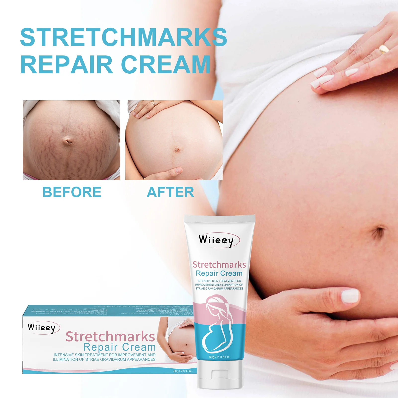 wiieey stretch marks repair cream WI HX 033 467