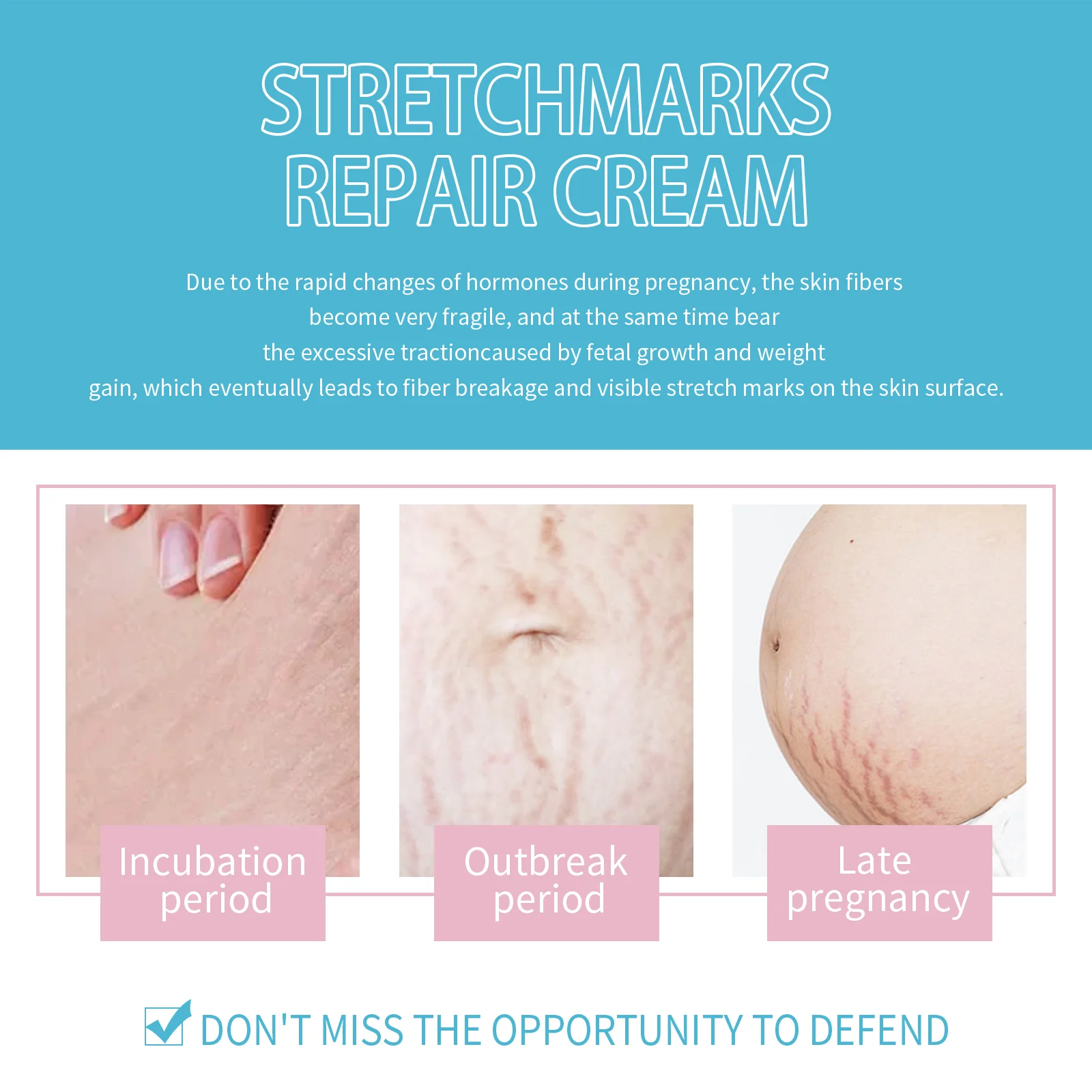 wiieey stretch marks repair cream WI HX 033 472