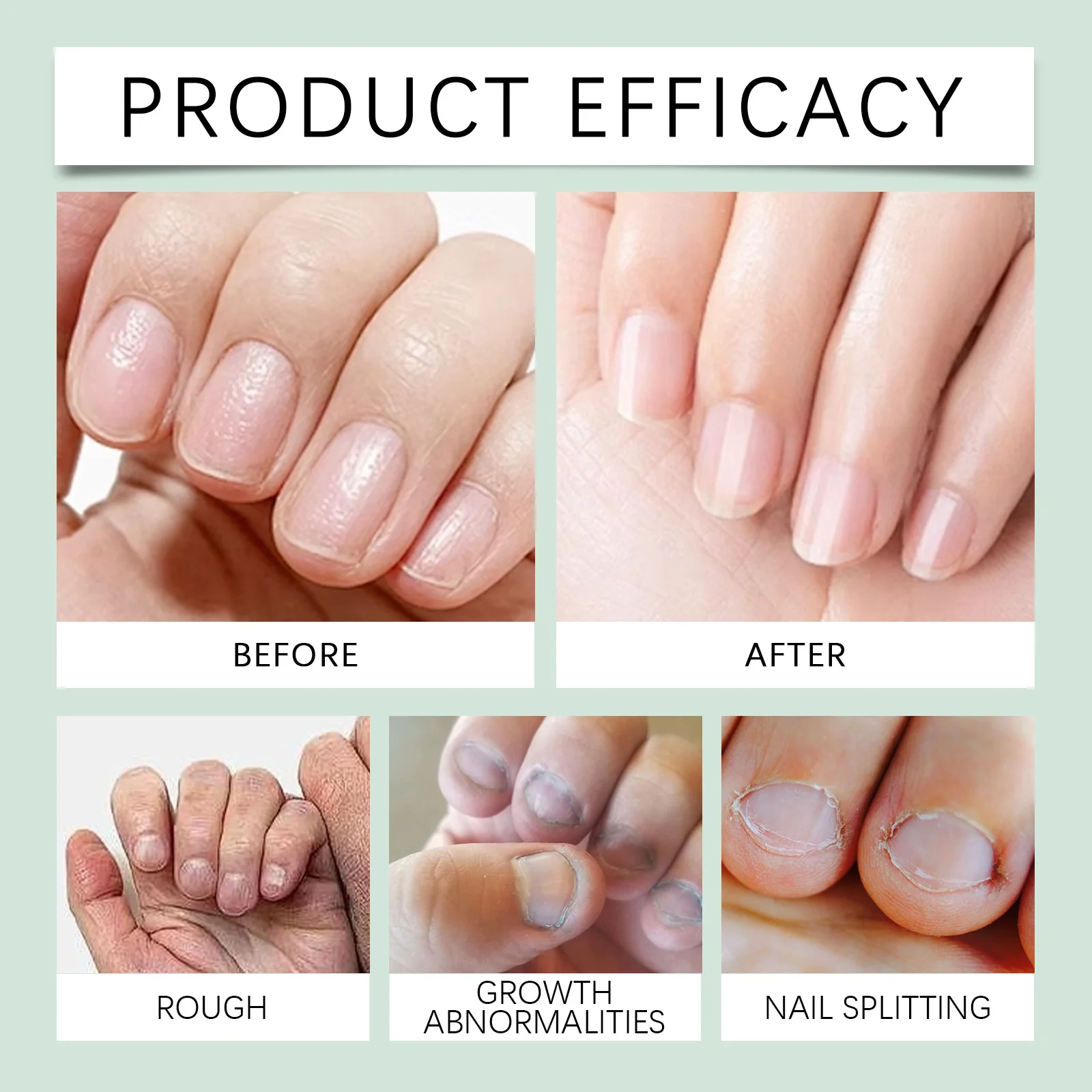 wiieey anti biting nail care bitter lotion WI HX 068 916