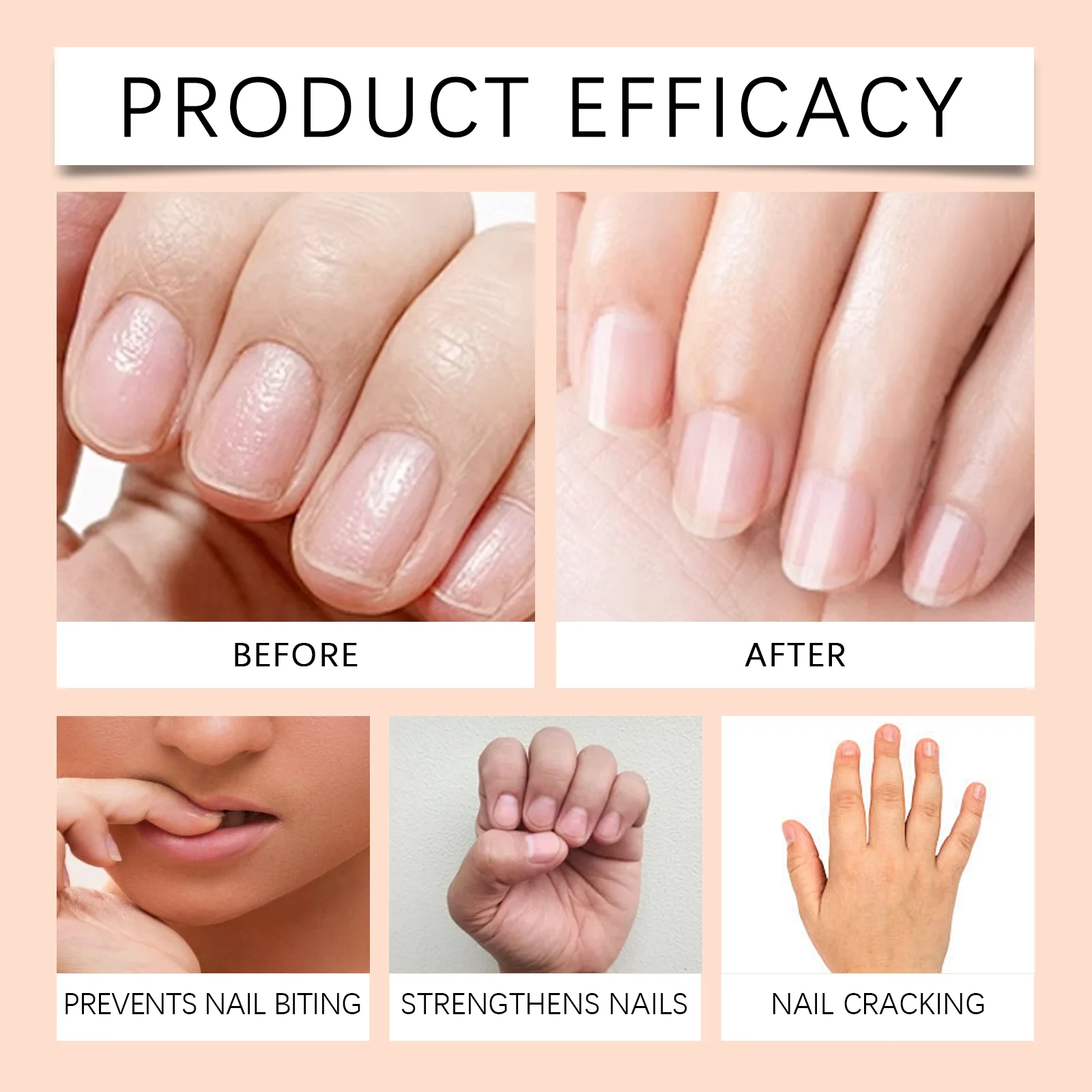 wiieey anti nail biting bitter pen children WI HX 084 1102