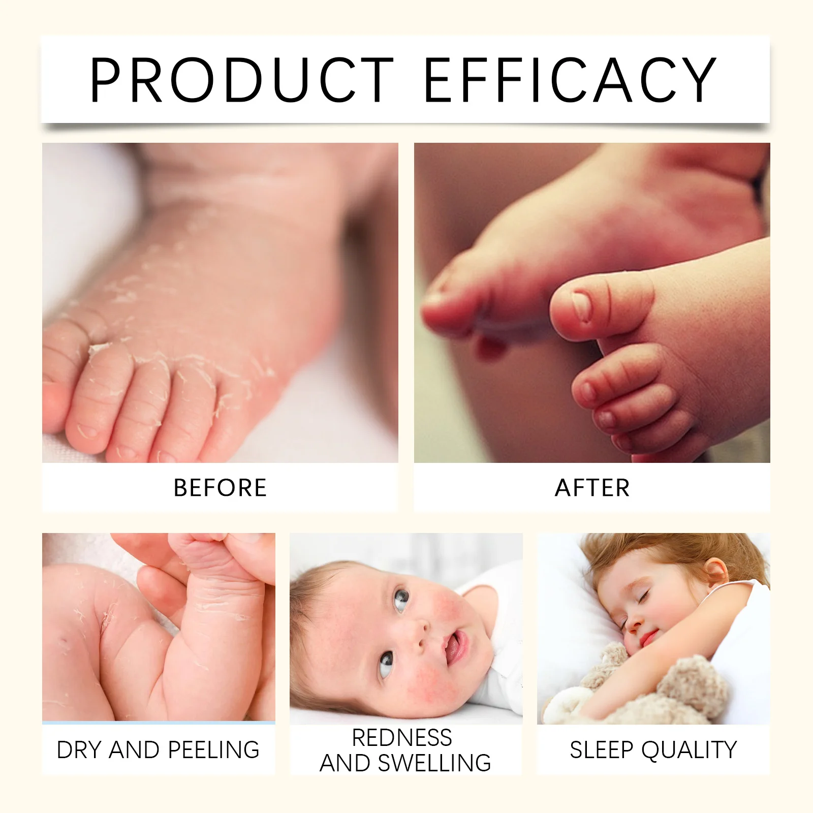 wiieey children moisturizing nourishing cream WI HX 089 1162