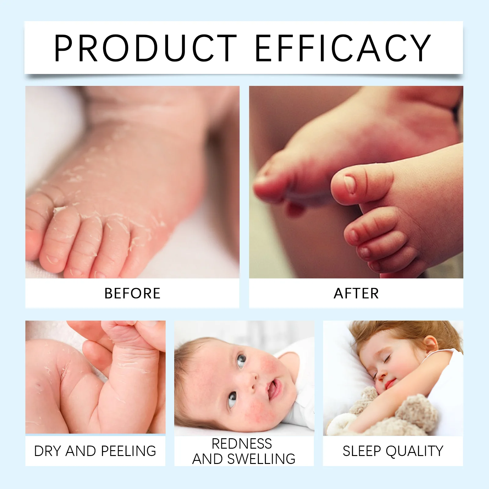wiieey children sleep moisturizer body cream WI HX 085 1115
