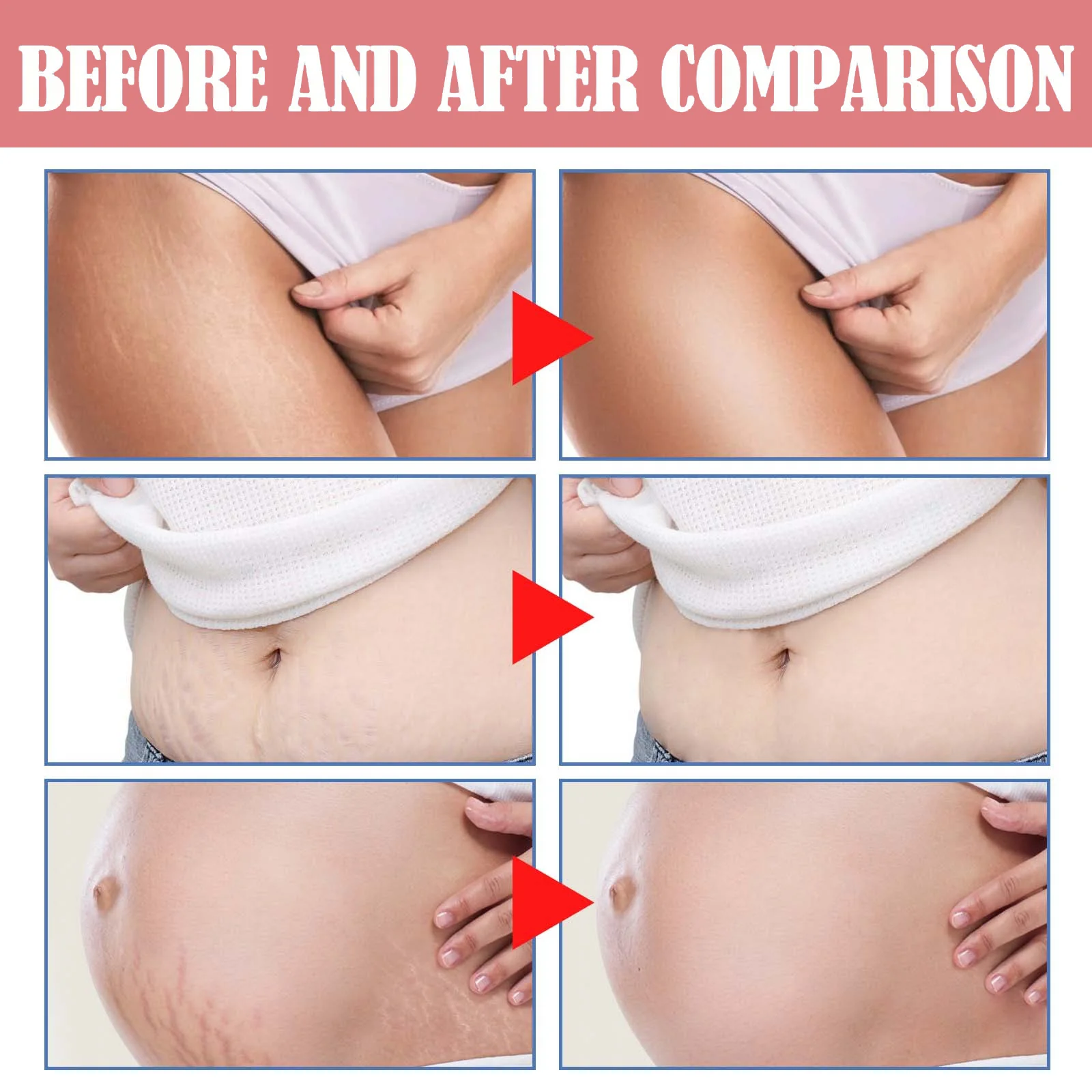 wiieey postpartum skin care firming cream WI HX 069 926